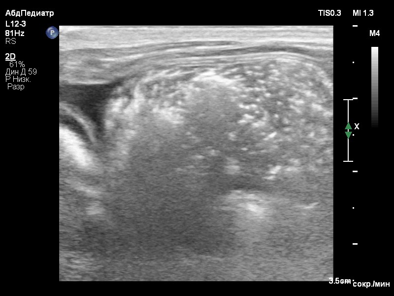 Фото 1 Фото 1