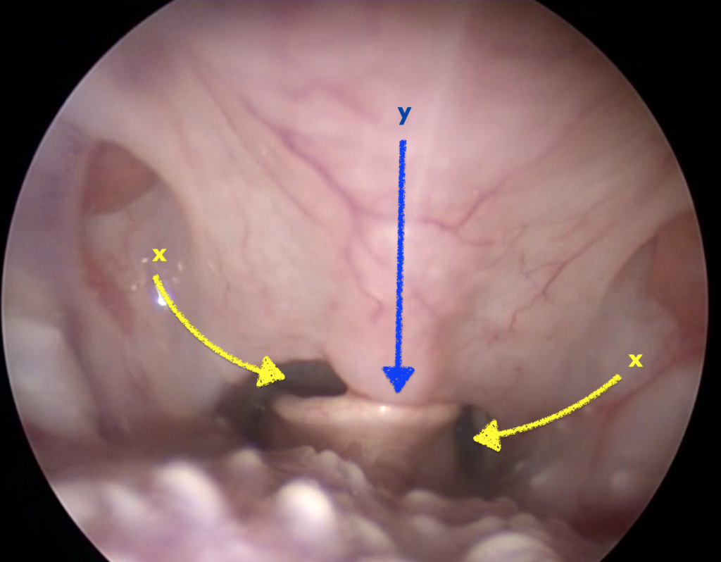 Рис 6б Рис 6б