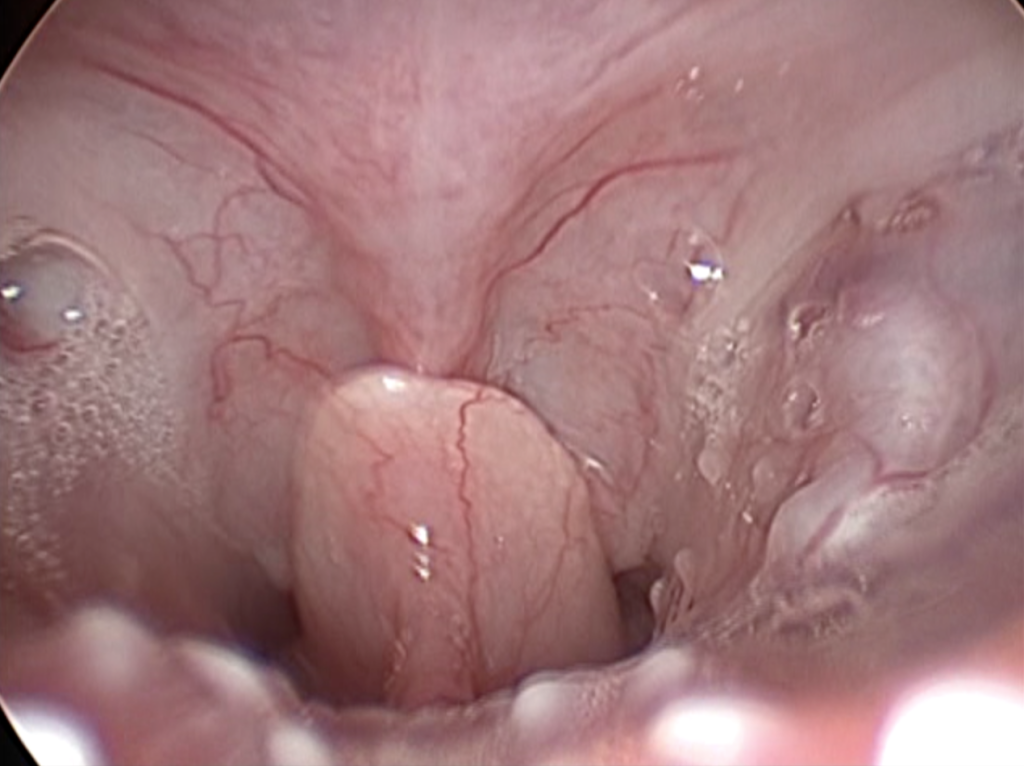 Рис 5а Рис 5а