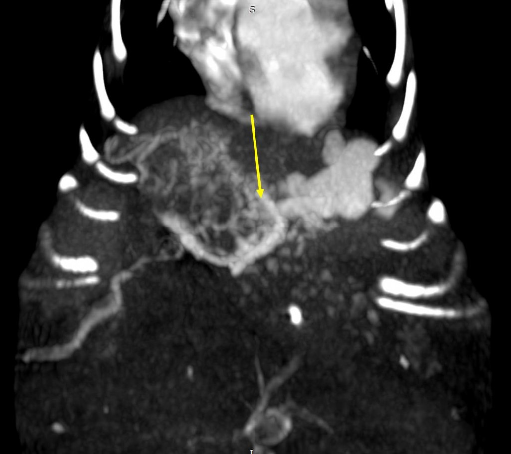 Рис 4 в Рис 4 в