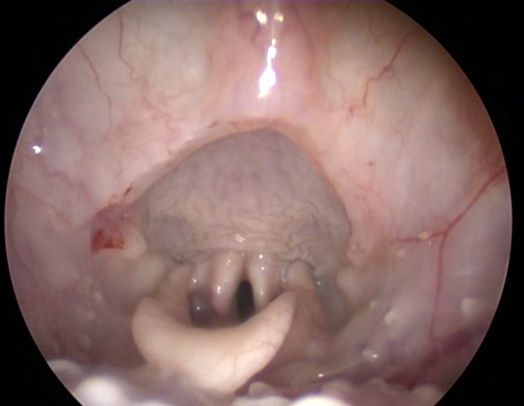 Рис 6а Рис 6а