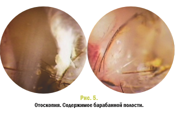 Рис 5 Рис 5