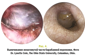 Рис 4 Рис 4