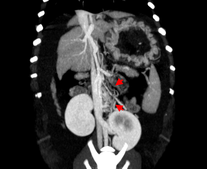 Рис 1 б Рис 1 б
