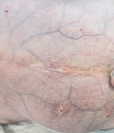 Фото 2A. Фото 2A.